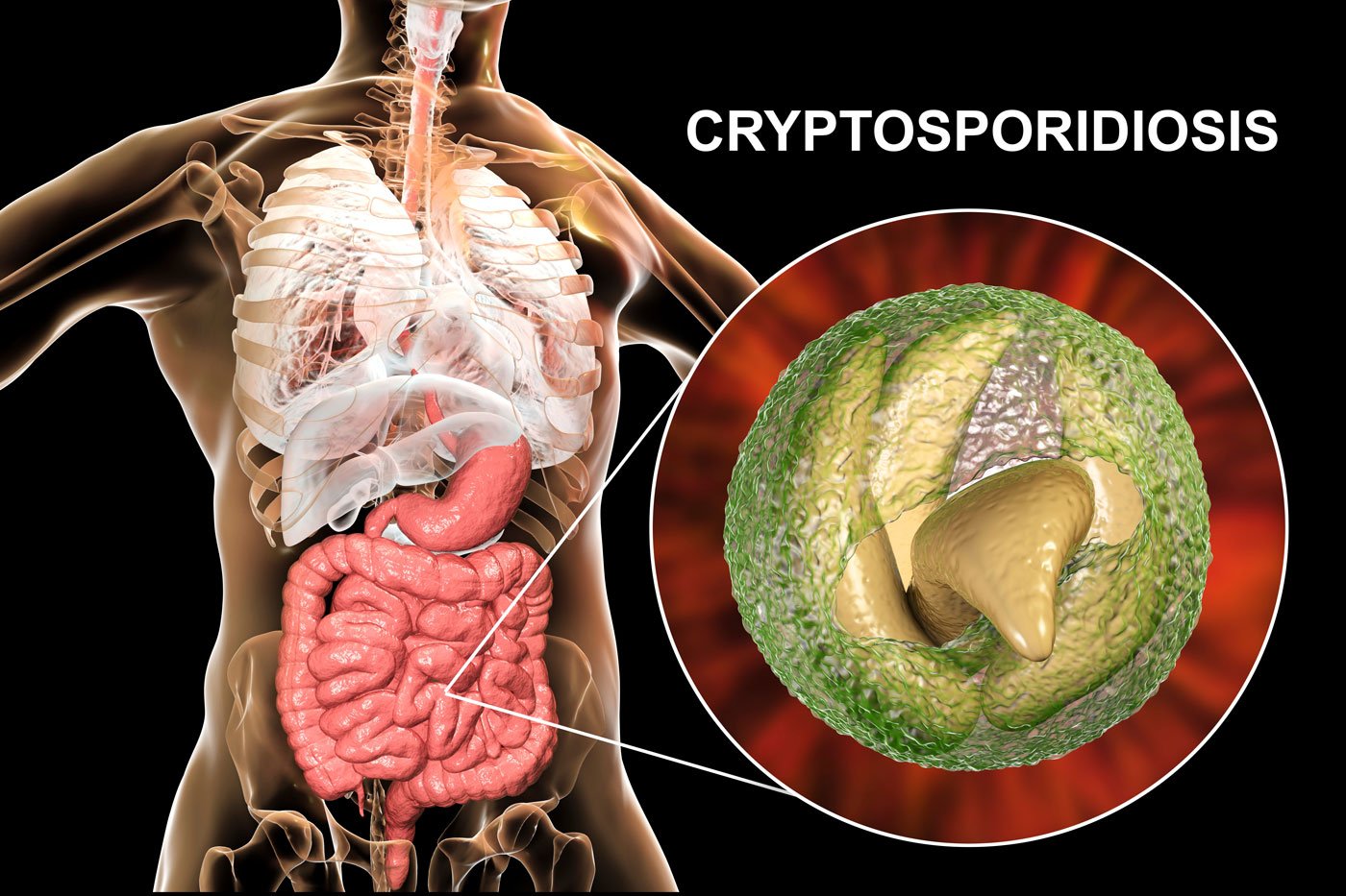 Cyrpto Disease